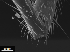 SEM image of a spider leg